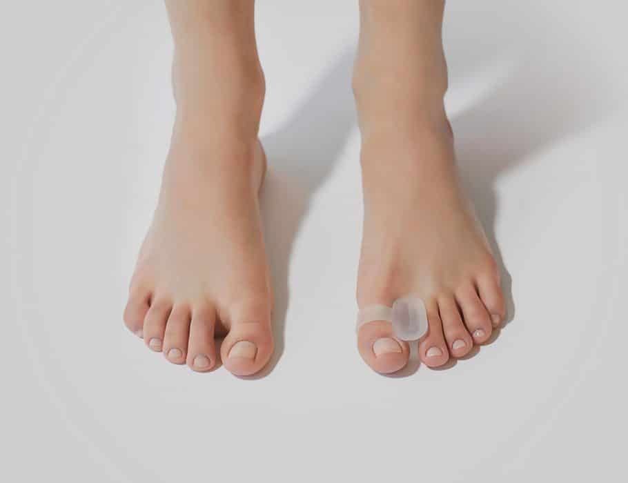 toe ring separator