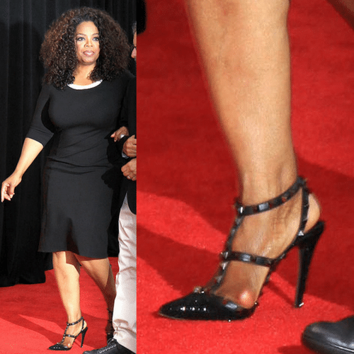 celebrity with bunion