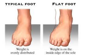 flat feet sketch